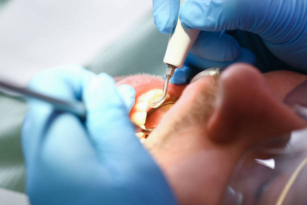 Best 24-Hour Emergency Dentist in Crown Pot, IN