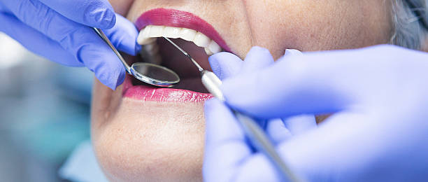 Best Same-Day Emergency Dentist in Crown Pot, IN